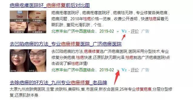 一个年入50万的正规挣钱项目，祛疤产品居然如此暴利！